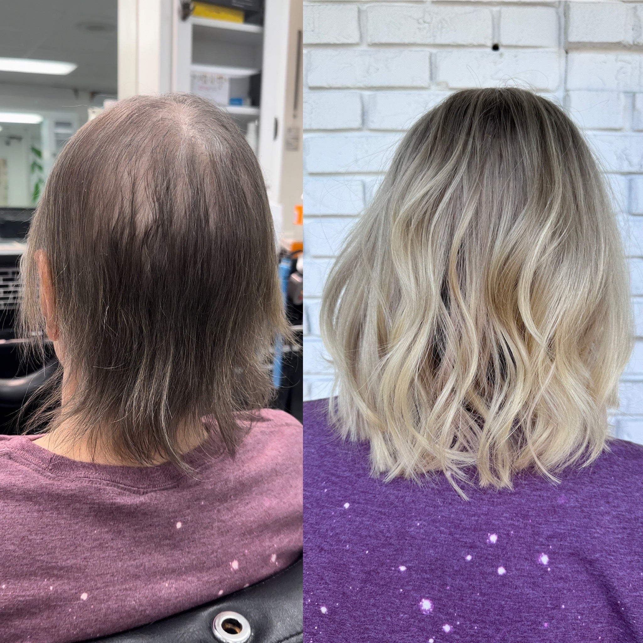 hair loss solutions, alopecia, hair thinning, mesh integration, meshless integration