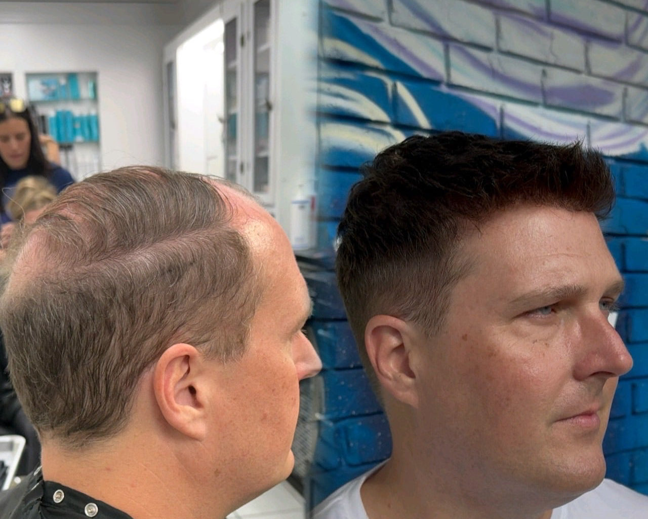 hair replacement system on male client 